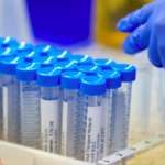 Texas Reports Its First Case Of The Omicron COVID-19 Variant